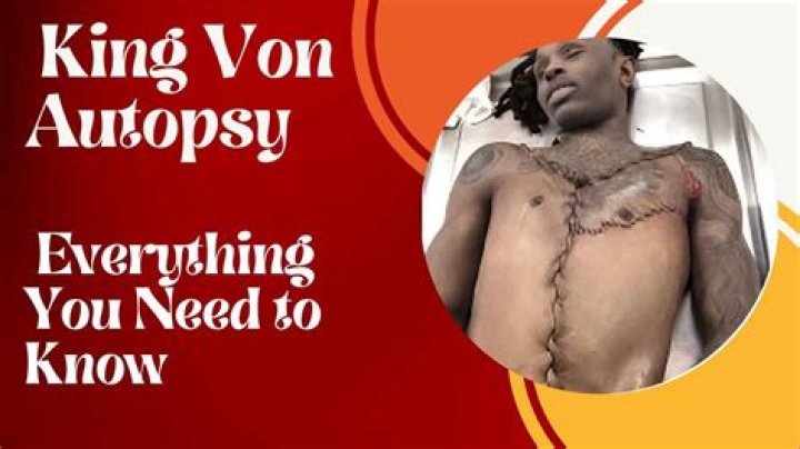 Unveiling The Truth: King Von Autopsy Insights